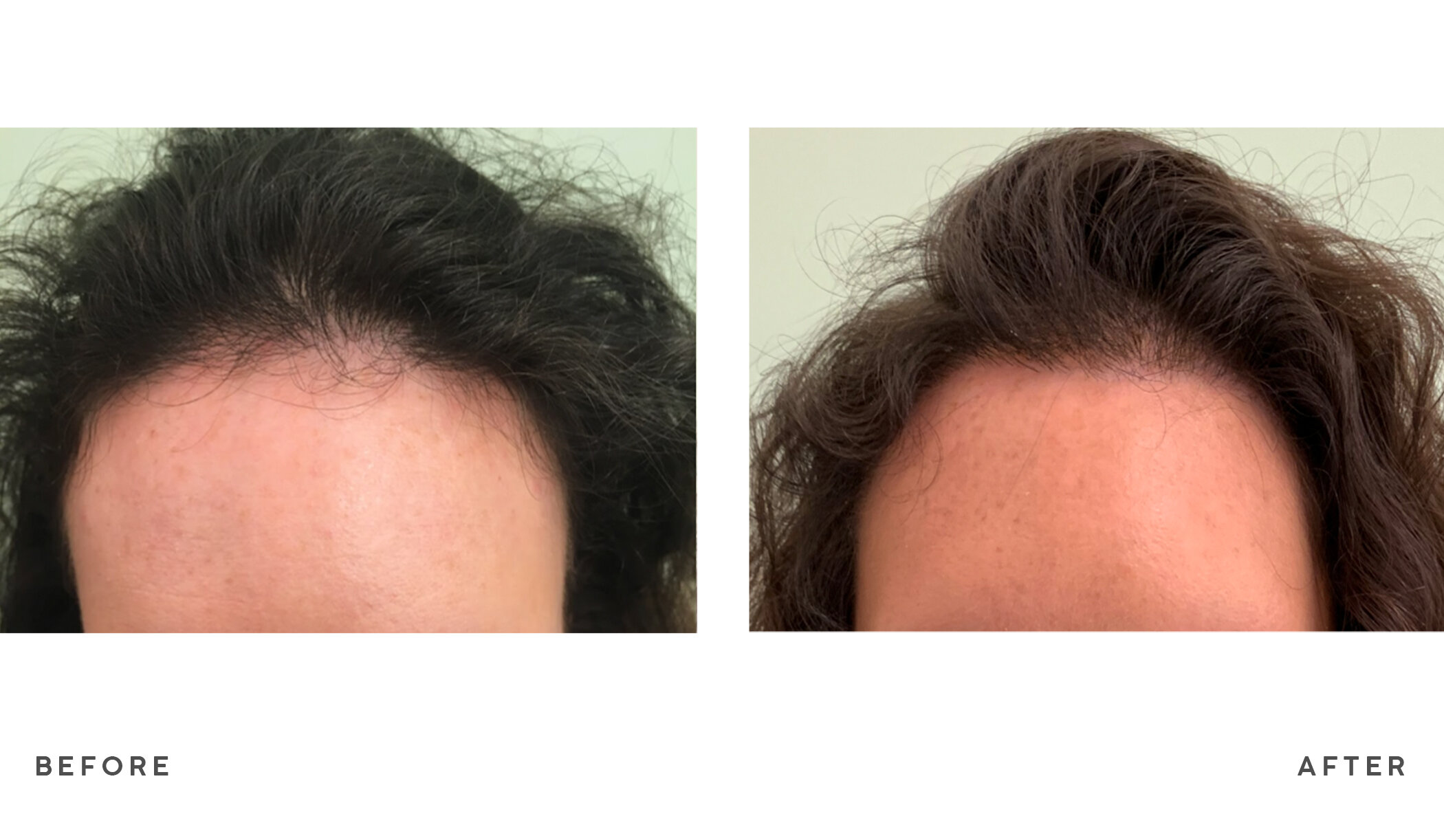 A patient's hair before and after