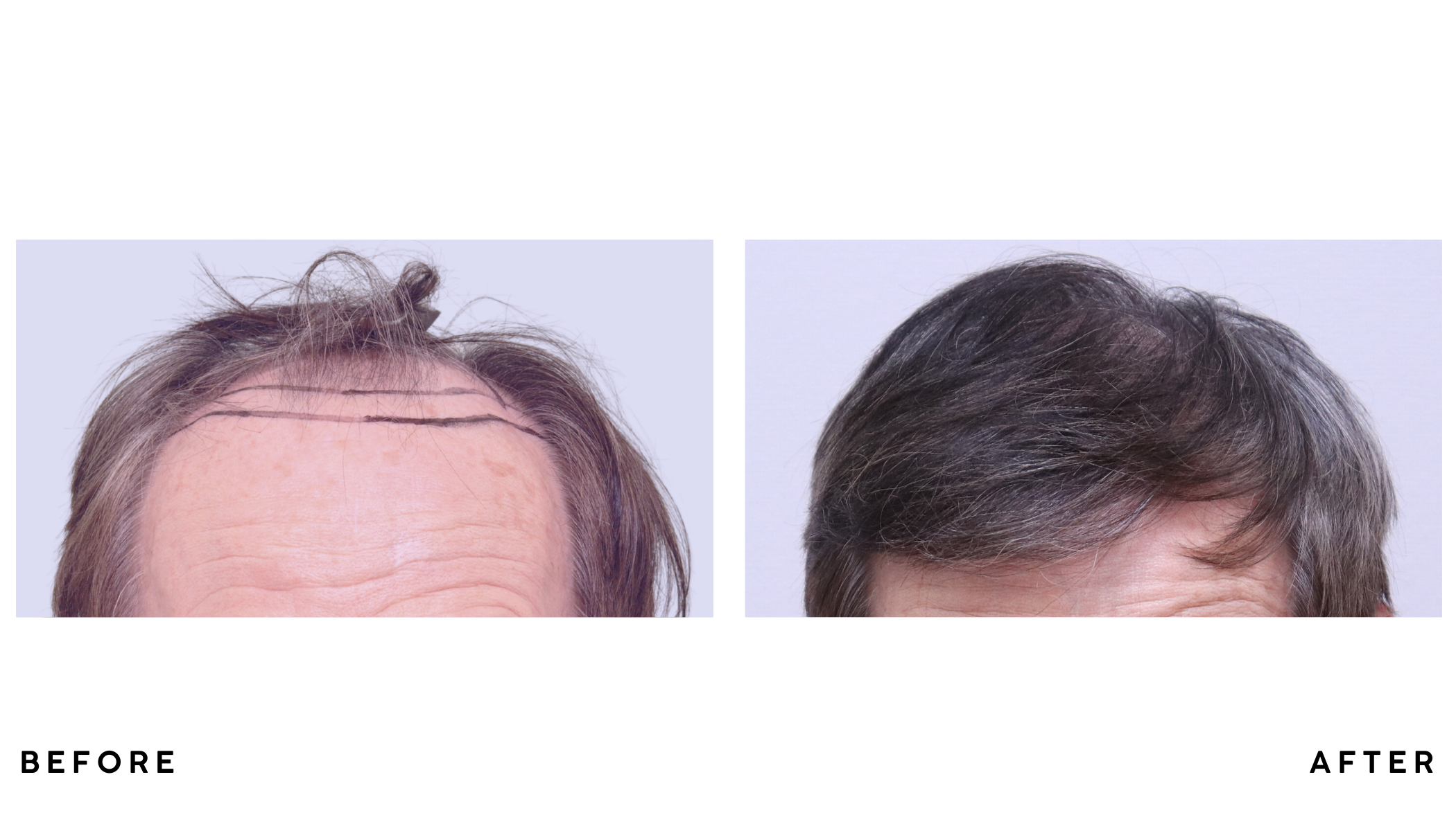 A patient's hair before and after