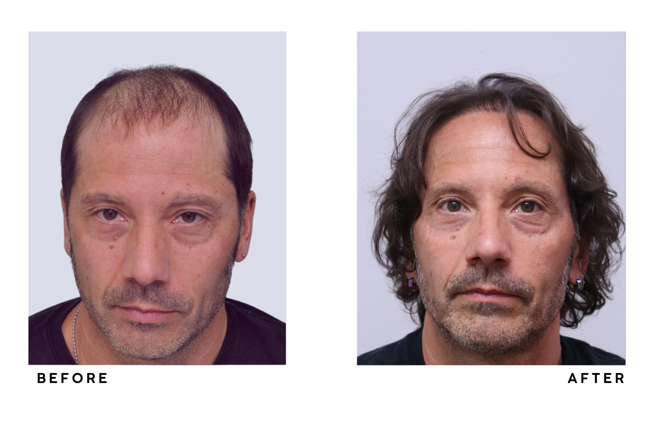 A patient's hair before and after
