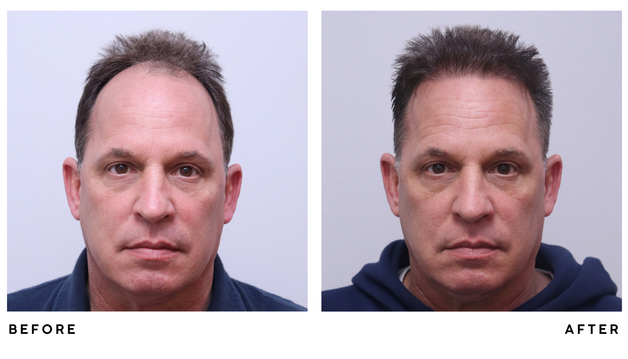 A patient's hair before and after